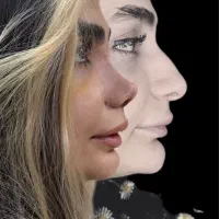 ۵۰ درصد تخفیف عمل جراحی بینی بدون تامپون با پیزو