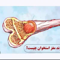 اهدا مغز واستخوان