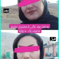 بمب چاقی صورت (با جوانه گندم)