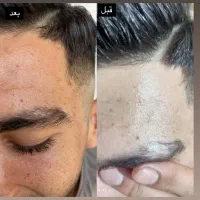سفارش پکیج کامل صورت|آرایشی، بهداشتی، درمانی|شیراز, بازار|دیوار