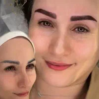 مدل میکروبلیدینگ وشیدینگ لب