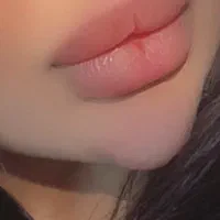 خدمات ژل و بوتاکس و انزیم