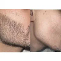 ریش و سبیل نداری نگران نباش من پیشتم