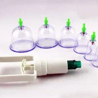 فیزیوتراپی ، حجامت ، بادکش