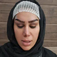 کاشت مو وابرو جشنواره ویژه|خدمات آرایشگری و زیبایی|یزد, |دیوار