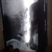 خرید ضایعات فیلم رادیولوژی