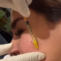 خدمات و آموزش فیشیال مزوتراپی میکروندلینگ|خدمات آرایشگری و زیبایی|اهواز, حصیرآباد|دیوار