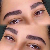 میکروبلیدینگ،شیدینگ،خط چشم،فیبروز