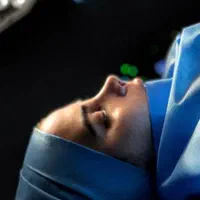 آف زیبایی عمل بینی ۱۹میلیون