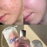 تونر روشن کننده+رفع تیرگی(ویتابلا)