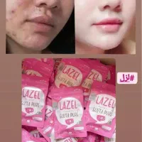 کرم سفید کننده صورت  بدن 10درجه سفیدی بدون بازگشت|آرایشی، بهداشتی، درمانی|زابل, |دیوار