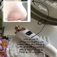 دستگاه میکرودرم|آرایشی، بهداشتی، درمانی|تنکابن, |دیوار