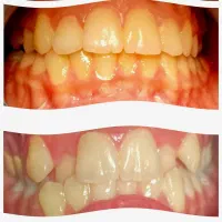 ارتودنسی ثابت