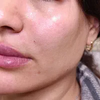 آموزش خدمات  پوست ،مو وزیبایی