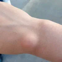 شکسته بند،طب سنتی استادحکیم|خدمات زیبایی و سلامت|تهران, هفده شهریور|دیوار