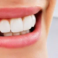 کامپوزیت لیرینگ و لبه شفاف / اقساط|خدمات زیبایی و سلامت|تهران, نارمک جنوبی|دیوار