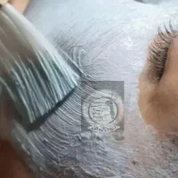 فیشال و اصلاح درما پلینگ