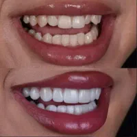 خدمات دندانپزشکی با قیمت مناسب|خدمات آرایشگری و زیبایی|تهران, مینابی|دیوار
