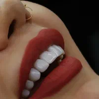 کامپوزیت دندان|خدمات آرایشگری و زیبایی|پرند, فاز ۶|دیوار