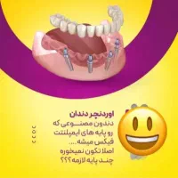 خدمات تخصصی ایمپلنت و اوردنچر دیجیتال|خدمات آرایشگری و زیبایی|کرج, جهان‌شهر|دیوار