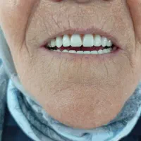 لابراتوار دندان سازی سلامت|خدمات آرایشگری و زیبایی|نیشابور, شریعتی|دیوار