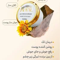 کرم ضدلک رویال|آرایشی، بهداشتی، درمانی|شیراز, دارالرحمه|دیوار