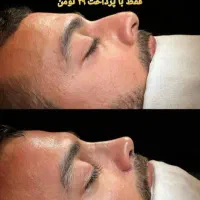 ابدومینوپلاستی.لیپو360.ماموپلاستی .پروتزسینه.بینی