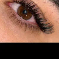 کاشت اکسیشن مژه