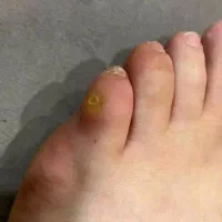 کفسابی پا.درمان ناخن پا.میخچه. ارتونیل ناخن پا|خدمات آرایشگری و زیبایی|کرج, کوی امامیه|دیوار