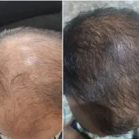 رویش مجدد در ۲۰ روز