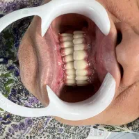 کارآموزی در لابراتوار دندانسازی