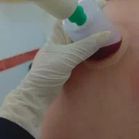 آموزش حجامت توسط پرستارخانوم|خدمات آموزشی|برازجان, |دیوار