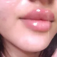 فیلر/ژل/بوتاکس ،بدون درد و کبودی|خدمات آرایشگری و زیبایی|شیراز, مسلم|دیوار