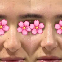 کرم کوچیک کننده بینی|آرایشی، بهداشتی، درمانی|قرقری, |دیوار