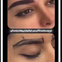 خدمات زیبایی/کاشت مو ، ابرو/بلفارو /جراحی بینی