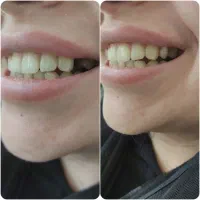 ( دندان سازی لبخند )|خدمات آرایشگری و زیبایی|زنجان, |دیوار