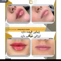 کاشت مو ابرو /بینی / اسلیو / بای پس /نقد و اقساط