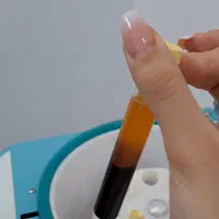 آموزش وخدمات فیشال،پی آرپی،مزوتراپی، مزونیدیلینگ|خدمات آرایشگری و زیبایی|کرج, گوهردشت|دیوار