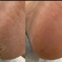 پدیکور خیس وکفسابی پاخدمات و اموزش خانمها