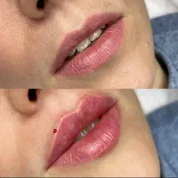 خدمات ژل بوتاکس مزوتراپی لاغری کاشت مو