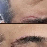 انجام خدمات زیبایی در کلینیک زیبایی
