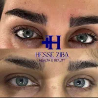 از دم قسط کاشت مو و ابرو بلفاروغبغب کلینیک حس زیبا|خدمات آرایشگری و زیبایی|اصفهان, سعادت‌آباد|دیوار