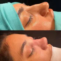 جراحی/بینی/اقساط/زیبایی/دکتر متخصص|خدمات آرایشگری و زیبایی|تهران, شهرک شریعتی|دیوار