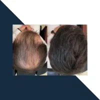 شونه دیگه لایه موهات نمیره