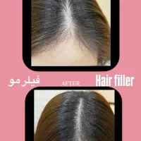 جشنواره لیزر مو تزریق ژل لب بوتاکس فیلر لیفت صورت|خدمات آرایشگری و زیبایی|تهران, ستارخان|دیوار
