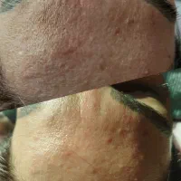 تخفیفات ویژه فیشال تخصصی