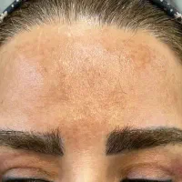 مجهزترین مرکزلیززقم حذف تتوابرو، بدن لک مقاوم صورت|خدمات آرایشگری و زیبایی|قم, بکایی|دیوار