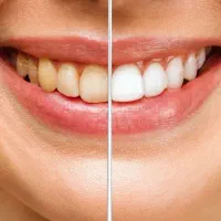 دندانپزشکی تجریش