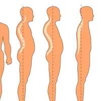 مرکز تخصصی اصلاح غیرجراحی انحرافات ستون فقرات