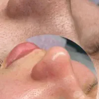 پاکسازی و فیشیال حرفه ای در خانه پوست من
